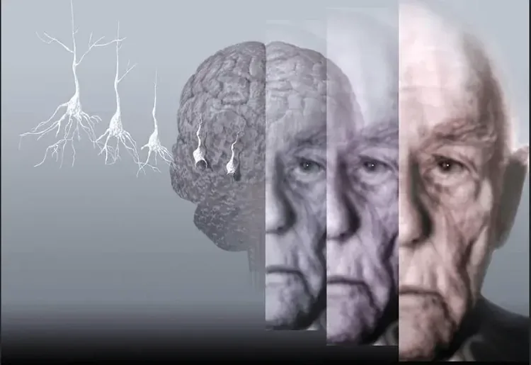 Montagem com neurônios, um cérebro e o rosto de um homem idoso em faixas sobrepostas